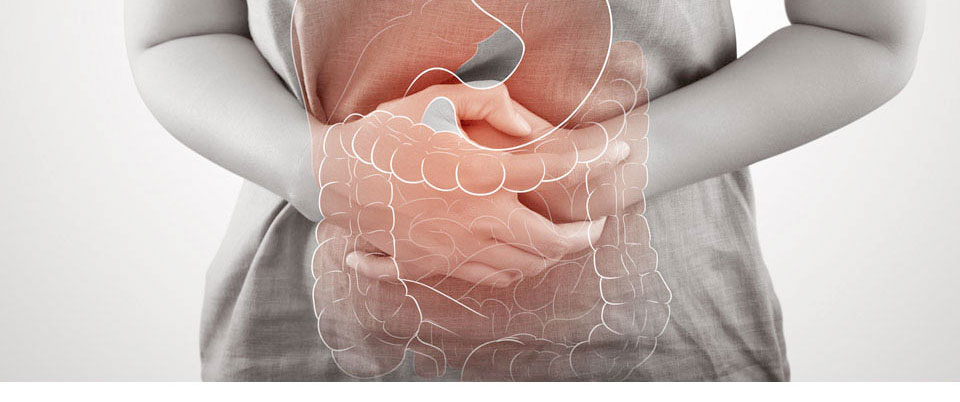 潰瘍性大腸炎の治療